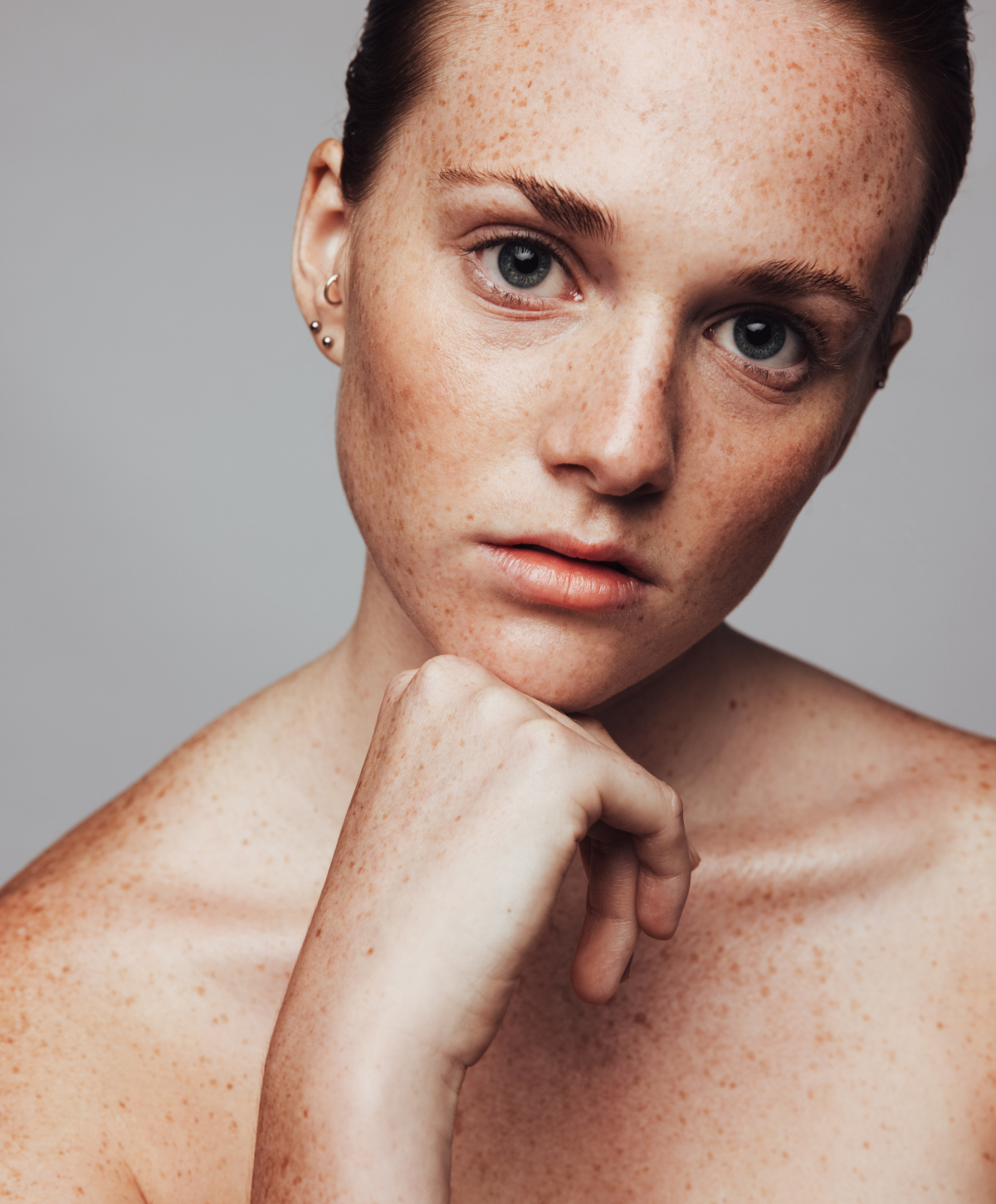 Sacramento microneedling model with brown eyes
