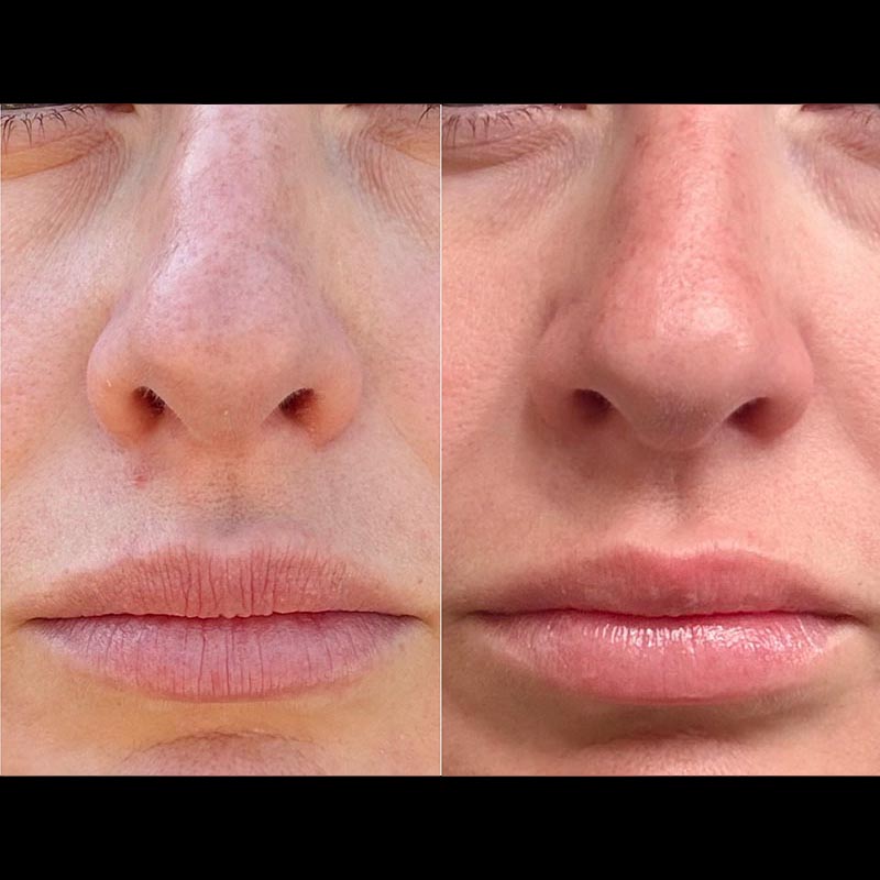 Skincare Before & After Image